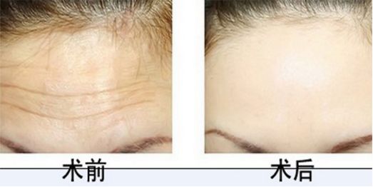 北京協(xié)和整形科的醫(yī)術(shù)高超，專家團(tuán)隊(duì)實(shí)力強(qiáng)大，您值得信賴