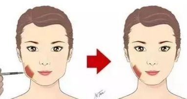 深圳整形圈熱門推薦！七位口碑高的假體豐臀醫(yī)生信息來襲！