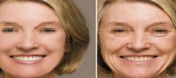 大連許英醫(yī)療美容如何？找到適合你的完美美容之處