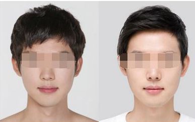 上海整形三甲醫(yī)院優(yōu)質(zhì)排行榜