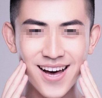 北京治疤痕手術(shù)哪家醫(yī)院好？