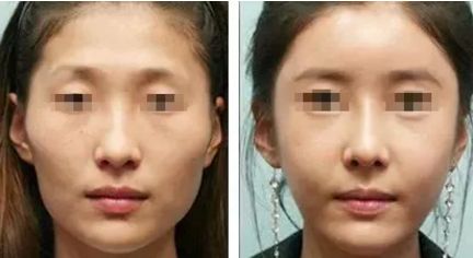 廣州有哪些知名整形醫(yī)院？