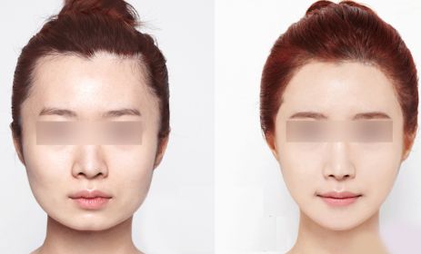 昆明哪里有最好的眼部手術(shù)整形醫(yī)院？2024年10家排名搶先曝光！