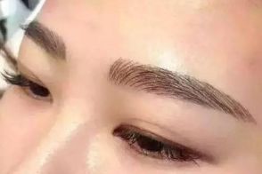 絕佳效果！體驗成都周維開刀雙眼皮的精彩案例