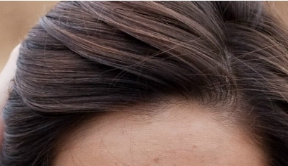 株洲愛思特醫(yī)療美容門診部有哪些擅長的項目推薦？