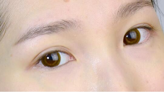 赤峰地區(qū)的鼻部整形熱門醫(yī)院到底有哪些？是否有推薦的醫(yī)院呢？