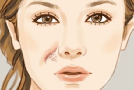 長沙亞韓醫(yī)院：專家親診！割雙眼皮價格解析和醫(yī)院簡介