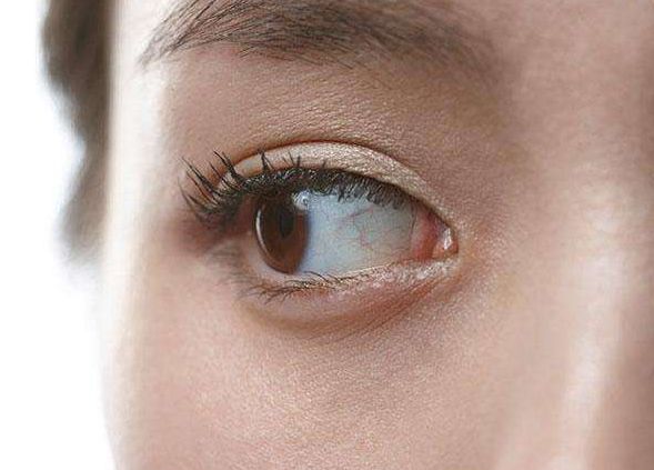 胡瓊?cè)A醫(yī)生：讓您雙眼皮煥然一新，聲譽卓越