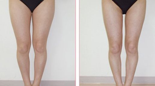 深圳市有哪些經(jīng)驗豐富的脂肪填充醫(yī)生？Top五名單揭曉！