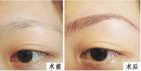 上海九院整形外科醫(yī)生排名新鮮發(fā)布！3位專(zhuān)家各具特長(zhǎng)！