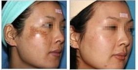 西京醫(yī)院郭樹忠教授：醫(yī)術(shù)高超，贏得廣泛口碑