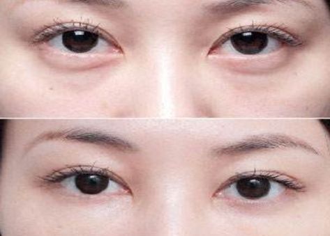 北京最受歡迎的整形醫(yī)院排名高居前三！私立醫(yī)美實(shí)力超越公立醫(yī)院！