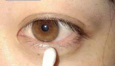 西京醫(yī)院：宋保強(qiáng)醫(yī)生主刀，隆胸手術(shù)安全可靠嗎？