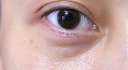 2023年度吉林頂級整形醫(yī)院排行曝光！震驚行業(yè)的前十強大揭曉！