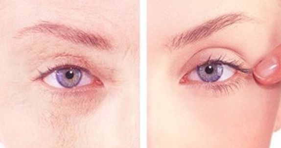 沈陽醫(yī)大二院美容整形科權(quán)威專家盛裝亮相，2023價格表曝光，丨真絕佳效果去眼袋案例讓人羨慕