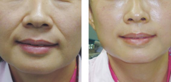 哪位醫(yī)生是擅長進行顱頜面手術的專家？名單更新與價格參考