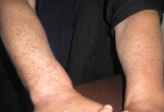 東菀膚康皮膚科醫(yī)院醫(yī)生資歷一覽——這家醫(yī)院的醫(yī)生們經(jīng)驗(yàn)豐富嗎？是否專(zhuān)業(yè)可靠？