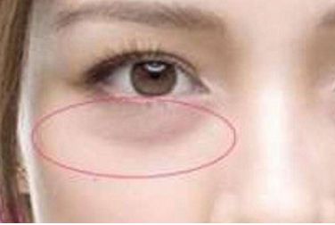 韓國優(yōu)質(zhì)整形醫(yī)院推薦，專業(yè)假體隆鼻術(shù)效果好