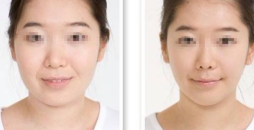 2024廣州首屈一指的整形醫(yī)療中心揭曉