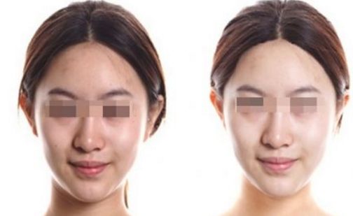 武漢皮膚科祛斑治療效果好在哪？名醫(yī)推薦+祛斑真實(shí)案例分享