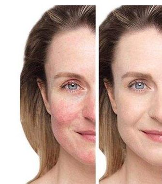 【長春市】優(yōu)質(zhì)整容醫(yī)院推薦！匯總前五家大熱門名單揭曉