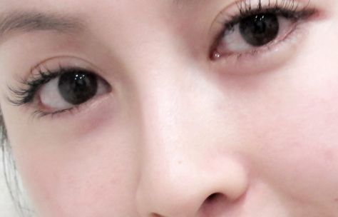 廣州熱瑪吉授權(quán)醫(yī)院有哪些好？