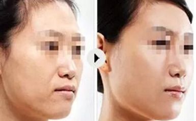 2024年大連優(yōu)質(zhì)整形醫(yī)院排行榜出爐，讓您輕松找到靠譜整形醫(yī)院