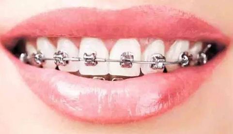 南京美容專家推薦：解決斑點問題的好去處！