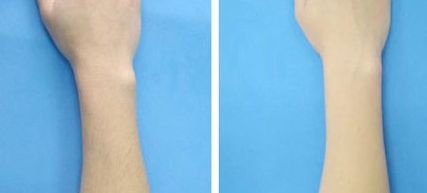 國內(nèi)哪些醫(yī)生做雙眼皮好？王曉亞、李燕、張穎熱門前五推薦！(2023價(jià)格表附)