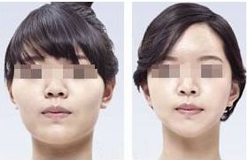 溫州哪個(gè)醫(yī)院有濡白天使注射項(xiàng)目