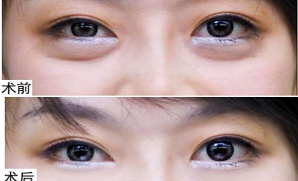 揭曉！鄭州2023年首屈一指的鼻部整形名醫(yī)TOP10震撼排行出爐