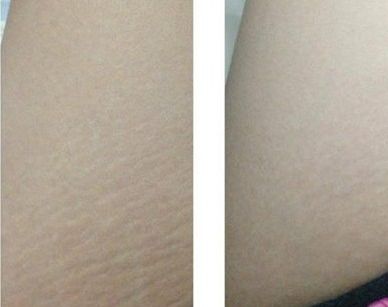 成都哪家醫(yī)院2023熱門雙眼皮全切推薦，醫(yī)院名單及簡(jiǎn)介全解析！