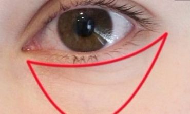 長(zhǎng)沙優(yōu)秀的雙眼皮修復(fù)醫(yī)生，找到周芳醫(yī)生和李超醫(yī)生