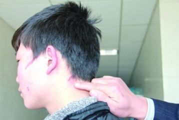 上海哪家醫(yī)院的紋身去除技術(shù)更專(zhuān)業(yè)，排名榜單推薦，實(shí)力強(qiáng)大！