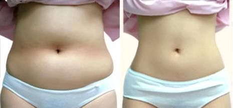 重慶五家聲譽良好的整形醫(yī)院公布，私立醫(yī)療機(jī)構(gòu)值得考慮