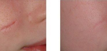 昆明知名醫(yī)生解讀三角眼與下垂眼手術(shù) 手術(shù)專業(yè)有哪些？