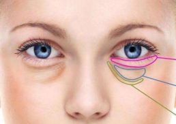 眼部整形北京，哪家醫(yī)院實(shí)力最強(qiáng)？三所醫(yī)院大比拼