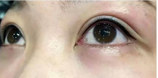 全面評估2023年全國雙眼皮手術(shù)醫(yī)生實力大揭秘