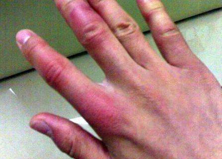 南京市哪家醫(yī)院能有效治療色斑問(wèn)題呢？