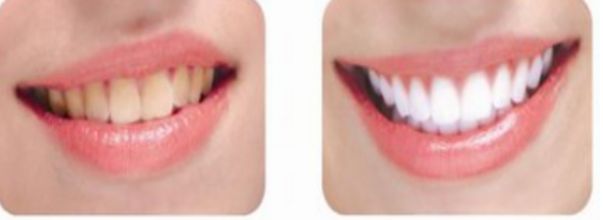 南昌哪家整形醫(yī)院的除皺手術(shù)比較好？前十實(shí)力醫(yī)院推薦!