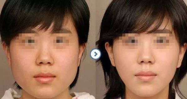 邯鄲梵星醫(yī)療美容：技術(shù)實(shí)力聚焦，項(xiàng)目擅長解讀，價(jià)格參考公開