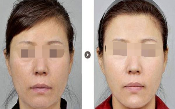 祁峰醫(yī)生面診全攻略：預(yù)約到面診流程詳細(xì)分享