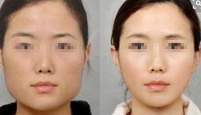 2024年鄭州市熱門整形醫(yī)院推薦，在排名前10中有哪些？