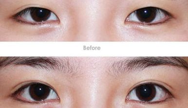 成都脂肪抽取手術(shù)的頂級醫(yī)師揭曉，五位技術(shù)高超的專家保證卓越效果