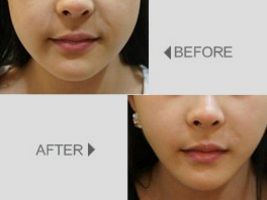 深圳整形醫(yī)院排行前三極具口碑，美麗同仁、藝星醫(yī)療、華美醫(yī)療引領(lǐng)潮流