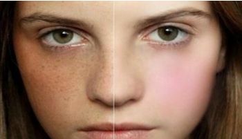 上海腹壁整形術(shù)受歡迎的醫(yī)院排行榜，九院、華美和伊萊美等備受推薦