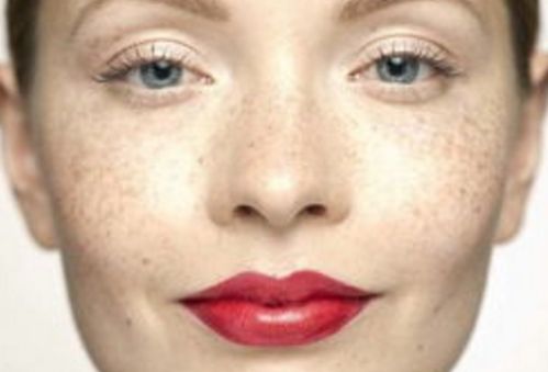 孫澤芳醫(yī)生的眼袋手術(shù)效果如何？醫(yī)生背景資料與實(shí)際手術(shù)對(duì)比圖分享