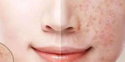 2023年大連顴骨顴弓修復(fù)醫(yī)生推薦，醫(yī)師排行公開(kāi)！附最新收費(fèi)一覽！