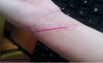 哈爾濱市第五醫(yī)院整容科負責人是誰？名醫(yī)陣容+服務價目公示給您參考