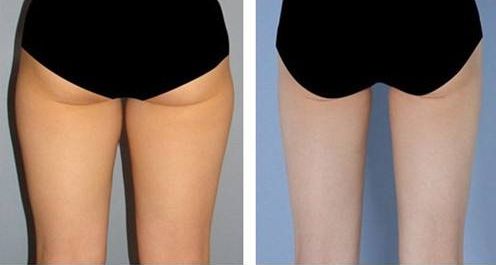 【2023】成都黃金微雕著名醫(yī)師盤點，你不容錯過！